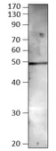 Anti-BMP8 antibody used in Western Blot (WB). GTX14934
