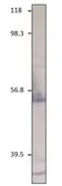 Anti-CXCR2 antibody used in Western Blot (WB). GTX14935