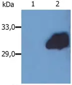 Anti-SOCS3 antibody [SO1] used in Western Blot (WB). GTX14939