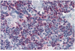Anti-SLP76 antibody used in IHC (Paraffin sections) (IHC-P). GTX14942