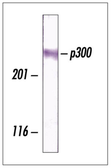 Anti-EP300 antibody [3G230] used in Western Blot (WB). GTX14984