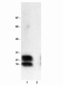 Anti-Phospholamban (phospho Ser16) antibody used in Western Blot (WB). GTX15000
