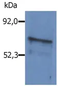 Anti-BLNK antibody used in Western Blot (WB). GTX15008