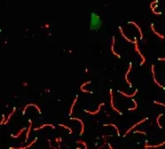 Anti-SCP1 antibody used in Immunocytochemistry/ Immunofluorescence (ICC/IF). GTX15090
