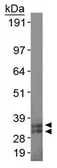 Anti-SCP3 antibody used in Western Blot (WB). GTX15093