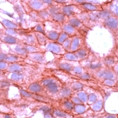 Anti-Her4 / ErbB4 antibody used in IHC (Paraffin sections) (IHC-P). GTX15137