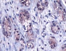 Anti-FRA2 antibody used in IHC (Paraffin sections) (IHC-P). GTX15296