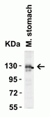 Anti-ACE2 antibody used in Western Blot (WB). GTX15349