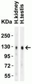 Anti-ACE2 antibody used in Western Blot (WB). GTX15349