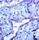 Anti-MMP23 antibody (ready-to-use) used in IHC (Paraffin sections) (IHC-P). GTX15479