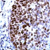 Anti-PCNA antibody used in IHC (Paraffin sections) (IHC-P). GTX15497