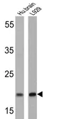 Anti-Presenilin 2 antibody [APS 26] used in Western Blot (WB). GTX15549