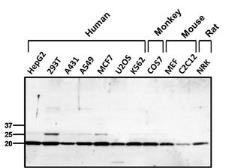 Anti-PRX I antibody used in Western Blot (WB). GTX15571