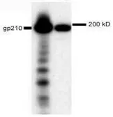 Anti-gp210 antibody, N-term used in Western Blot (WB). GTX15600