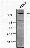 Anti-gp210 antibody, C-term used in Western Blot (WB). GTX15601
