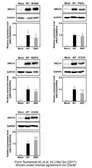 Anti-MRP4 antibody [M4I-10] used in Western Blot (WB). GTX15602