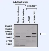Anti-Nesprin 1 antibody [6A] used in Western Blot (WB). GTX15604