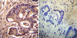 Anti-alpha Actinin 4 antibody [7H6] used in IHC (Paraffin sections) (IHC-P). GTX15648