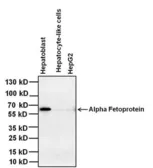 Anti-Alpha fetoprotein / AFP antibody [P5B8] used in Western Blot (WB). GTX15650