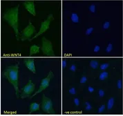 Anti-Wnt4 antibody, Internal used in Immunocytochemistry/ Immunofluorescence (ICC/IF). GTX15699