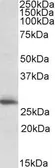 Anti-CLPP antibody, C-term used in Western Blot (WB). GTX15708