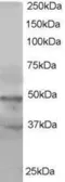 Anti-BAF53A + BAF53B antibody used in Western Blot (WB). GTX15718