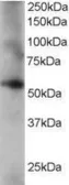 Anti-Coronin 1C antibody, C-term used in Western Blot (WB). GTX15719