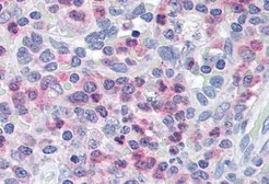 Anti-Munc 13-4 antibody, C-term used in IHC (Paraffin sections) (IHC-P). GTX15723