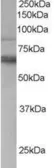 Anti-TEM8 antibody, C-term used in Western Blot (WB). GTX15724