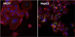 Anti-Ferritin antibody [523] used in Immunocytochemistry/ Immunofluorescence (ICC/IF). GTX15744
