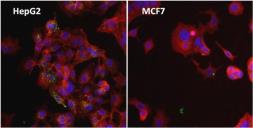 Anti-Ferritin antibody [513C10] used in Immunocytochemistry/ Immunofluorescence (ICC/IF). GTX15745