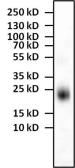 Anti-IL4 antibody [E10021] used in Western Blot (WB). GTX15758