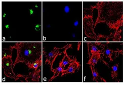 Anti-CXCL8 / IL8 antibody [3IL8-H10] used in Immunocytochemistry/ Immunofluorescence (ICC/IF). GTX15763