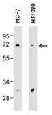 Anti-MMP2 antibody [F14 P4 D3] used in Western Blot (WB). GTX15772