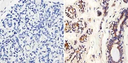 Anti-MMP2 antibody [MMP2/2C1-1D12] used in IHC (Paraffin sections) (IHC-P). GTX15773