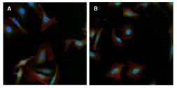 Anti-gamma Tubulin antibody [4D11] used in Immunocytochemistry/ Immunofluorescence (ICC/IF). GTX15794