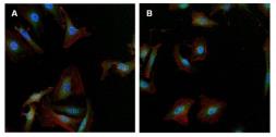 Anti-gamma Tubulin antibody [4D11] used in Immunocytochemistry/ Immunofluorescence (ICC/IF). GTX15794