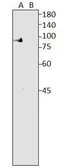 Anti-Lactoferrin antibody used in Western Blot (WB). GTX15811