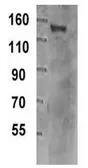 Anti-TIF1 gamma antibody [16G9] used in Western Blot (WB). GTX15826
