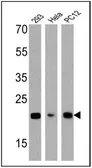 Anti-Diablo antibody [SMAC 17 1-87] used in Western Blot (WB). GTX15827