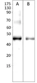 Anti-AMACR antibody used in Western Blot (WB). GTX15894