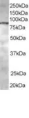 Anti-CENTB1 antibody, C-term used in Western Blot (WB). GTX15903