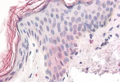 Anti-ZIC5 antibody, C-term used in IHC (Paraffin sections) (IHC-P). GTX15965