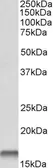 Anti-Cystatin B antibody, C-term used in Western Blot (WB). GTX15970