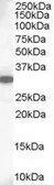 Anti-MCL1 antibody, C-term used in Western Blot (WB). GTX16013