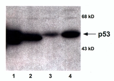 Anti-p53 antibody used in Western Blot (WB). GTX16121