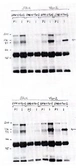 Anti-VAV2 antibody used in Western Blot (WB). GTX16136