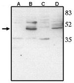 Anti-CHX10 antibody used in Western Blot (WB). GTX16141