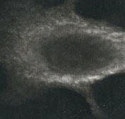 Anti-Calreticulin antibody used in Western Blot (WB). GTX16144