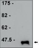 Anti-TrpE antibody [17] used in Western Blot (WB). GTX16153